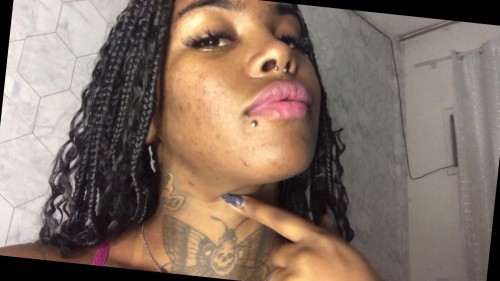 Black Girl Pimple Fetish ( Format: HD